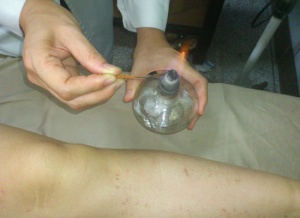 �����Ʒ�