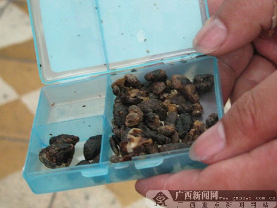 你会花上千元掏耳屎吗?柳州10多市民被 游医 