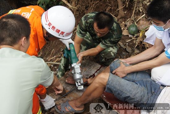 直径20毫米钢筋从天而降 工人脚踝被刺穿(图