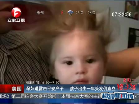 美国:孕妇遭雷击平安产子 <em>孩子</em>出生一年<em>头发</em>仍