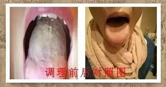 瑞典乳腺癌患者的中国之旅 尝试中医治疗癌症