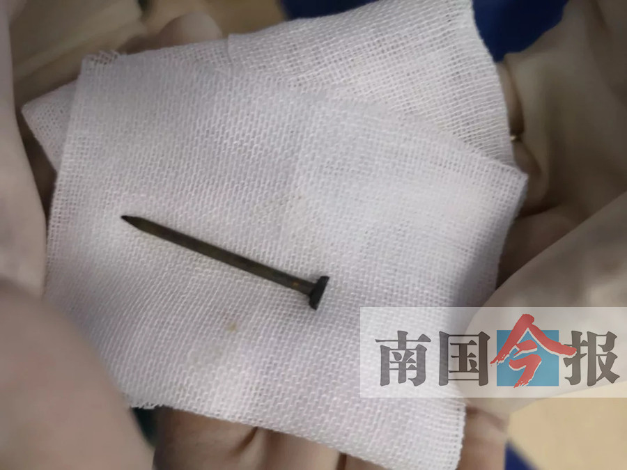 微创取出 事发三江,医院专家团队相互配合,在最短时间内成功完成手术
