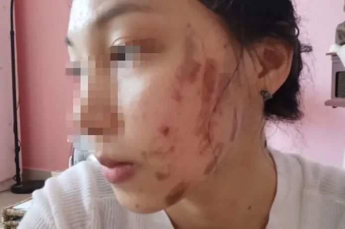 开始,小玥在店里只做身体按摩项目,后来觉得店里的美容师按摩手法