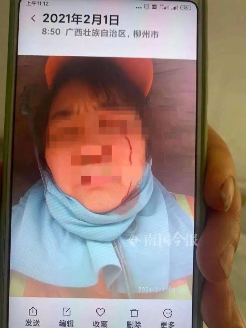 劝阻男子吐口水，广西一名环卫女工当街遭暴打！（最新发布）