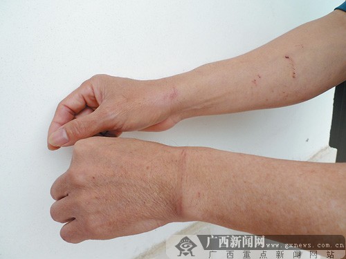 做生意起纠纷非法拘禁合伙人索钱 钱没到受尽折磨