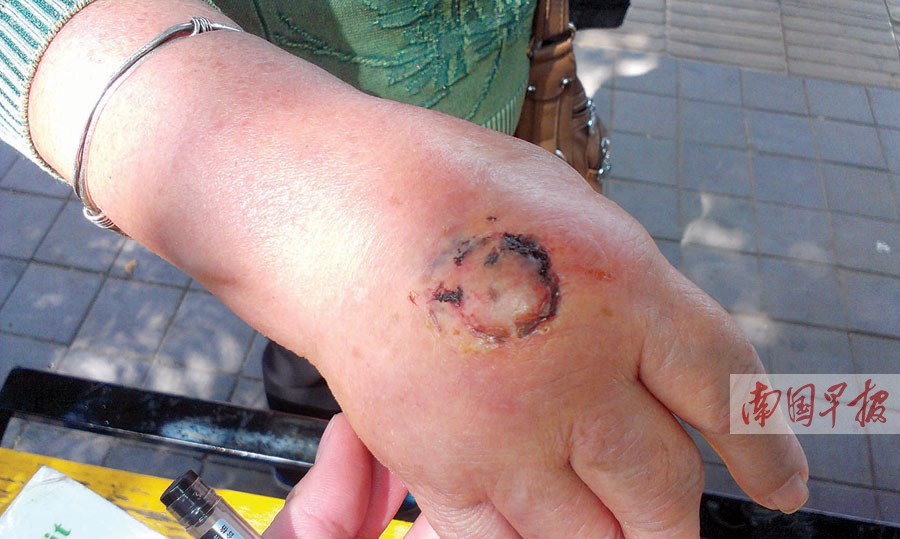 女子小学门前突然发狂咬伤两名老太 疑精神病患者