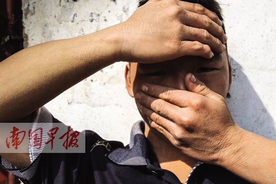 19岁小伙身患鱼鳞病 病情严重时皮肤像褐色老树皮