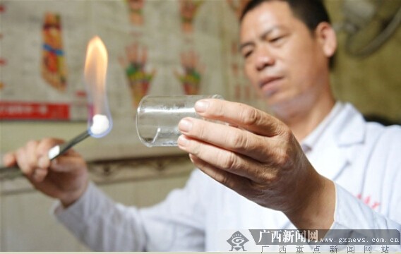 4月29日,梁鸿牡点燃酒精棉球,准备为患者拔火罐.