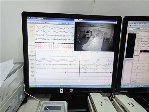 医生对阿伟进行睡眠试验监测 记者叶祯 摄