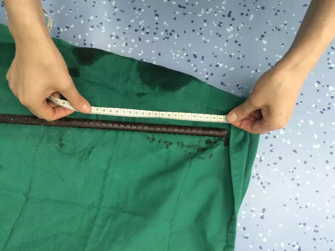 惊心动魄!钢筋插入工友腹部 国壮成功取出(图)