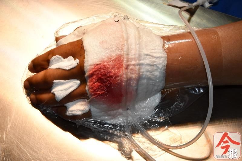 蛇伤专家救了蛇伤草医,这件事4,5月要格外小心 (3)