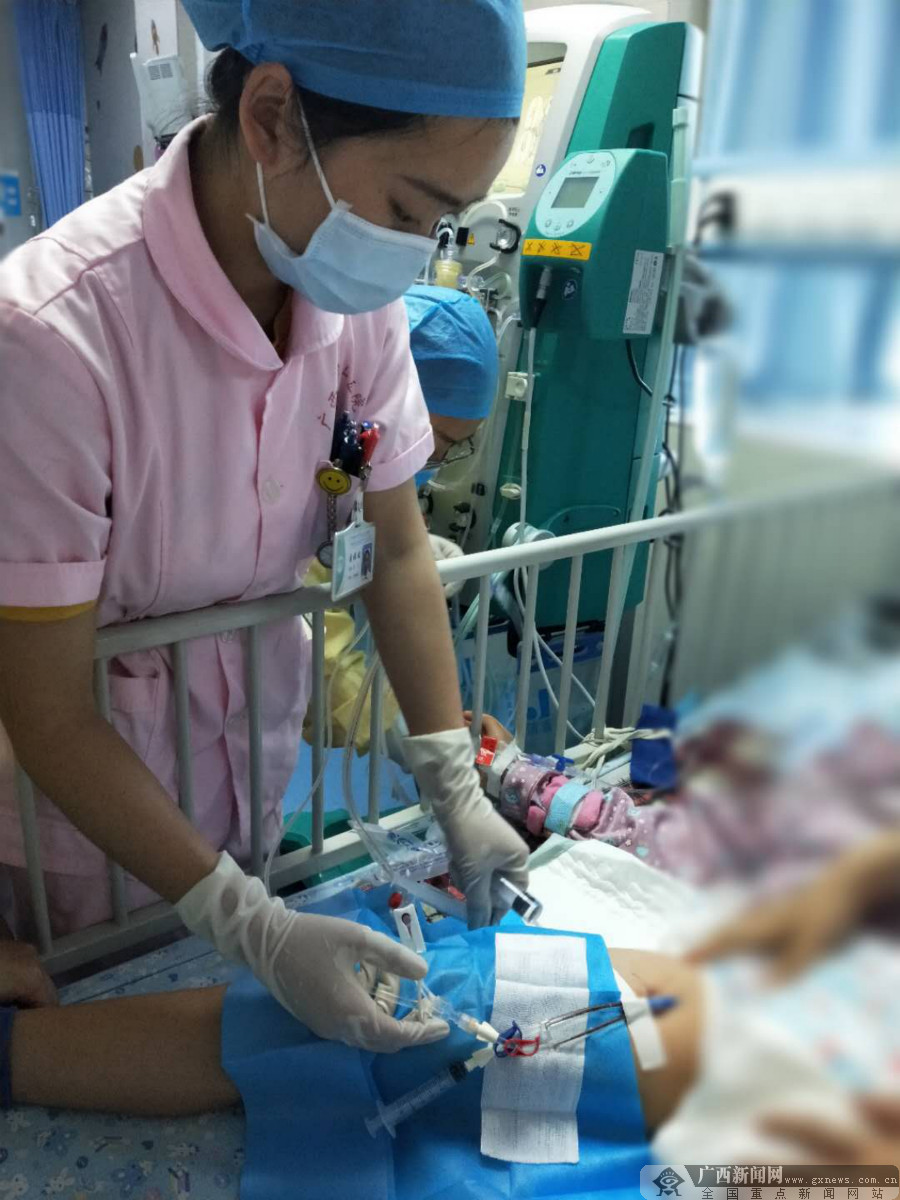 南溪山医院成功完成桂林市首例儿童血液净化治疗