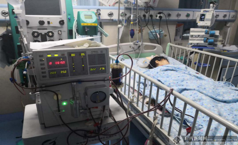 患儿在进行血液灌流联合持续血液滤过透析治疗.