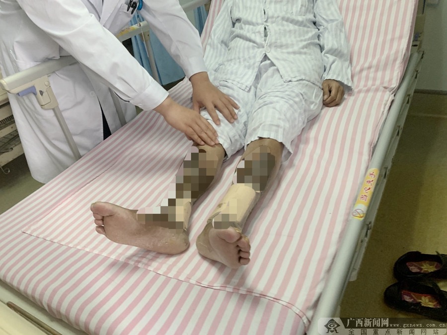 广西老烂腿医院